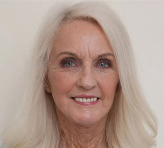 Toni Goldenberg - Harley Street Skin Clinic